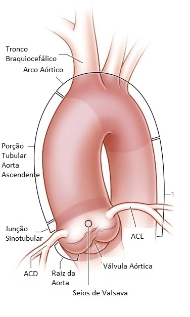 porcoes-da-aorta